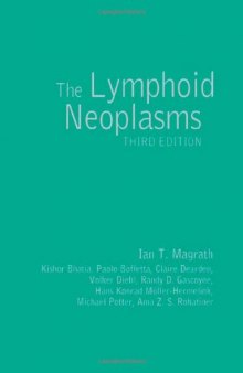 The lymphoid neoplasms