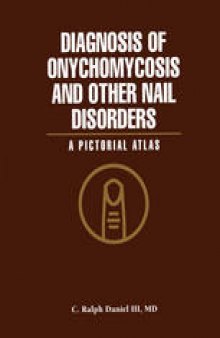 Diagnosis of Onychomycosis and Other Nail Disorders: A Pictorial Atlas