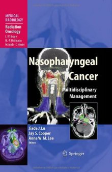 Nasopharyngeal Cancer: Multidisciplinary Management 