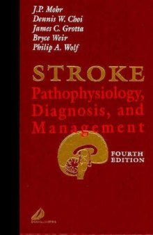 Stroke. Pathophysiology, Diagnosis, and Management
