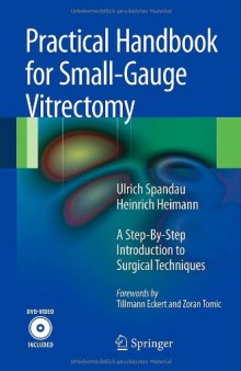Practical Handbook for Small-Gauge Vitrectomy: A Step-by-Step Introduction to Surgical Techniques  