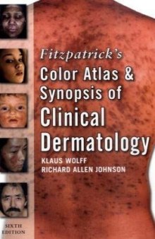 Fitzpatrick's Color Atlas and Synopsis of Clinical Dermatology: Sixth Edition 