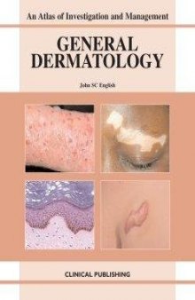 General Dermatology: An Atlas of Investigation and Management