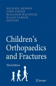 Children's Orthopaedics and Fractures