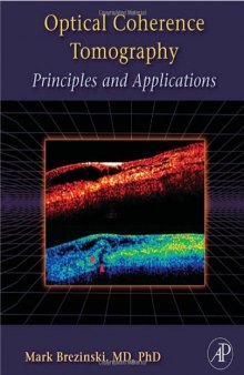 Optical Coherence Tomography: Principles and Applications