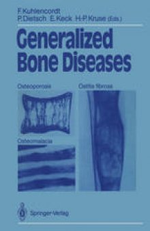 Generalized Bone Diseases: Osteoporosis Osteomalacia Ostitis fibrosa