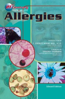 Allergies (21st Century Health and Wellness)