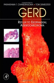 GERD: Reflux to Esophageal Adenocarcinoma  