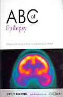 ABC of epilepsy