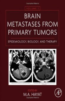 Brain Metastases from Primary Tumors. Epidemiology, Biology, and Therapy