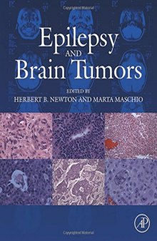 Epilepsy and Brain Tumors