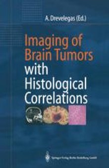 Imaging of Brain Tumors with Histological Correlations