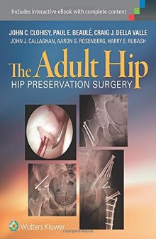 The Adult Hip: Hip Preservation Surgery