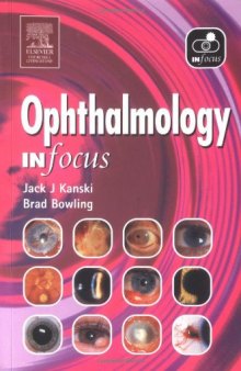 Ophthalmology In Focus, 1e