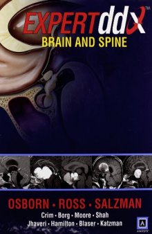 Expertddx: Brain and spine  