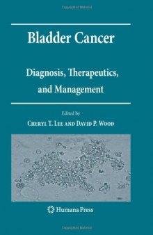 Bladder Cancer: Diagnosis, Therapeutics, and Management