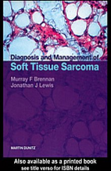 Diagnosis and management of soft tissue sarcoma