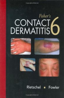 Fisher's Contact Dermatitis, 6e