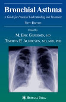 Bronchial Asthma: A Guide for Practical Understanding and Treatment