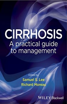 Cirrhosis : a practical guide to management