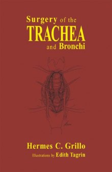 Surgery of the trachea and bronchi
