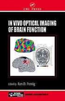 In vivo optical imaging of brain function