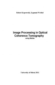 Image processing in optical coherence tomography using Matlab