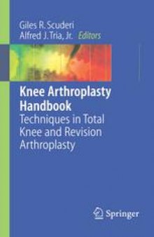 Knee Arthroplasty Handbook: Techniques in Total Knee and Revision Arthroplasty