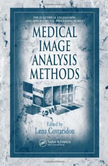 Medical Image Analysis Methods