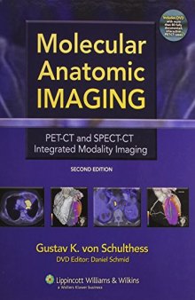 Molecular Anatomic Imaging: PET-CT and SPECT-CT Integrated Modality Imaging