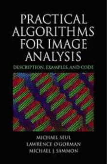 Practical algorithms for image analysis: description, examples, and code