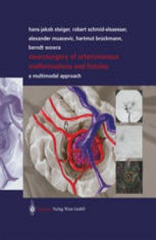 Neurosurgery of Arteriovenous Malformations and Fistulas: A Multimodal Approach