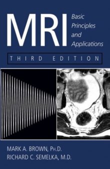 MRI Atlas Orthopedics and NeurosurgeryThe Spine