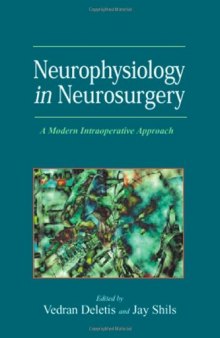 Neurophysiology in Neurosurgery: A Modern Intraoperative Approach