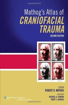 Mathog’s Atlas of Craniofacial Trauma