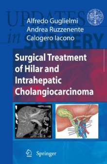 Surgical Treatment of Hilar and Intrahepatic Cholangiocarcinoma