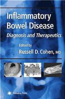 Inflammatory bowel disease : diagnosis and therapeutics