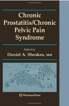 Chronic prostatitis. Chronic pelvic pain syndrome