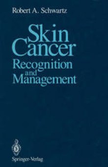 Skin Cancer: Recognition and Management
