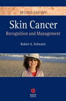 Skin Cancer: Recognition and Management, Second Edition