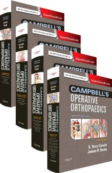 Campbell’s Operative Orthopaedics: 4-Volume Set