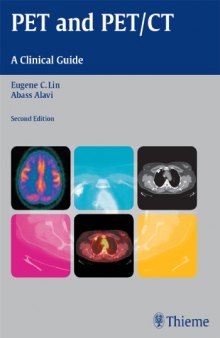 PET and PET/CT: A Clinical Guide  2nd ed
