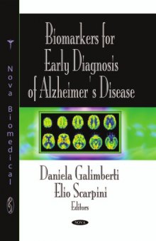 Biomarkers for early diagnosis of Alzheimer's disease