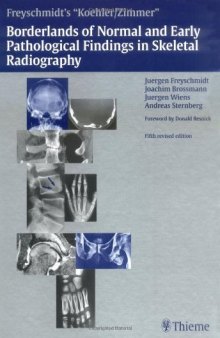 Koehler Zimmer's Borderlands of Normal and Early Pathological Findings in Skeletal Radiography