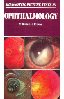 Diagnostic Picture Tests in Ophthalmology  