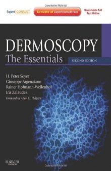Dermoscopy: The Essentials: Expert Consult - Online and Print, 2e