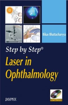 Step by Step Laser in Ophthalmology
