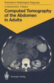 Computed Tomography of the Abdomen in Adults: 85 Radiological Exercises for Students and Practitioners