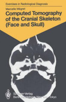 Computed Tomography of the Cranial Skeleton (Face and Skull): 58 Radiological Exercises for Students and Practitioners