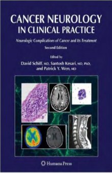 Cancer Neurology in Clinical Practice-Neurologic Complications of Cancer and Its Treatment